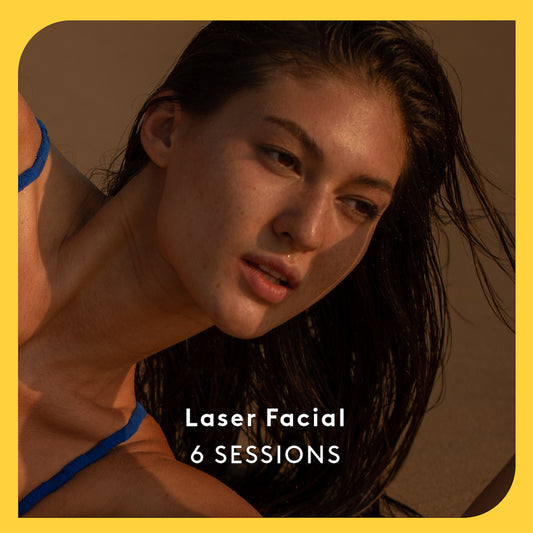 Laser Facial - 6 Sessions